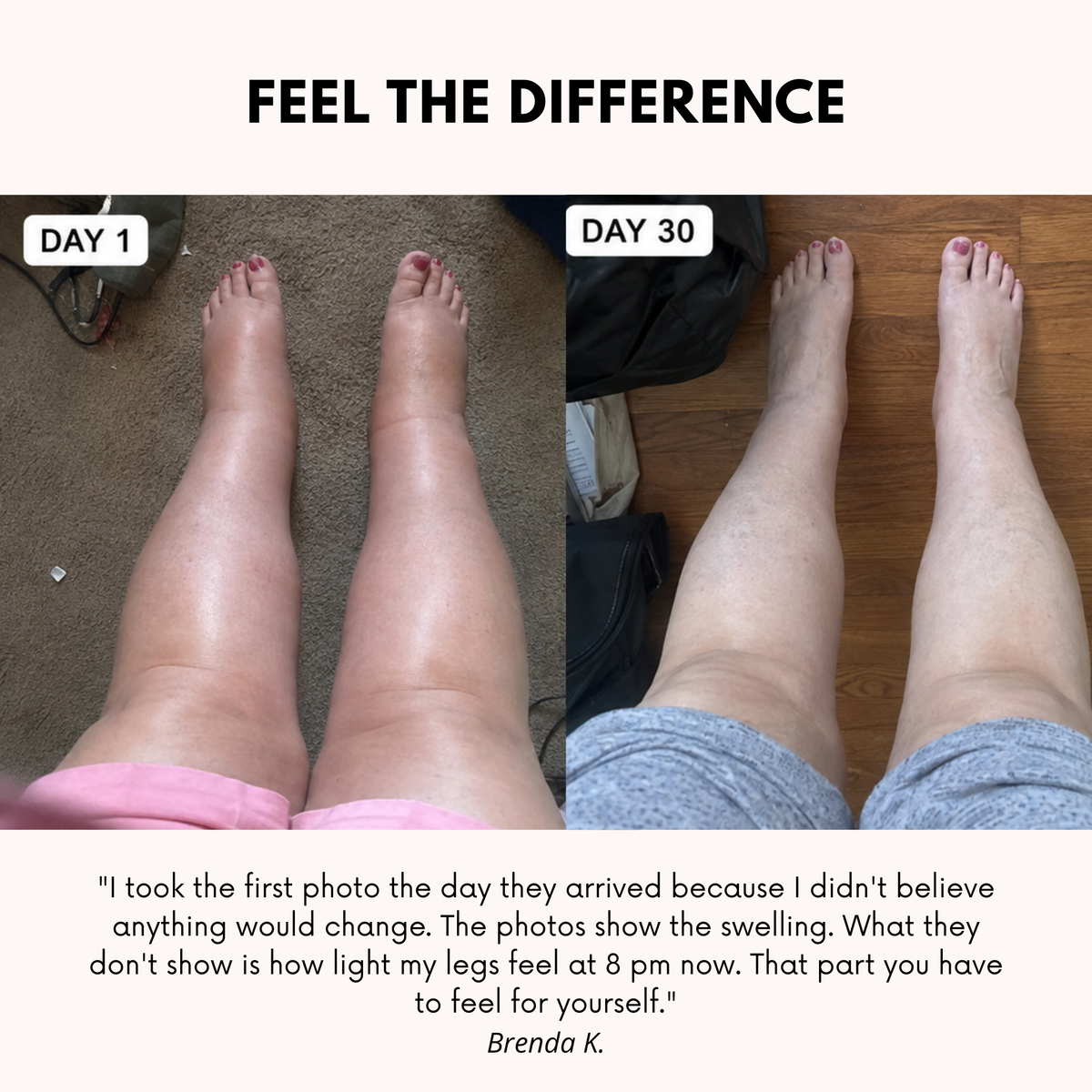 POWERCELLS™ | Light-Legs & Anti-Swelling Compression Leggings
