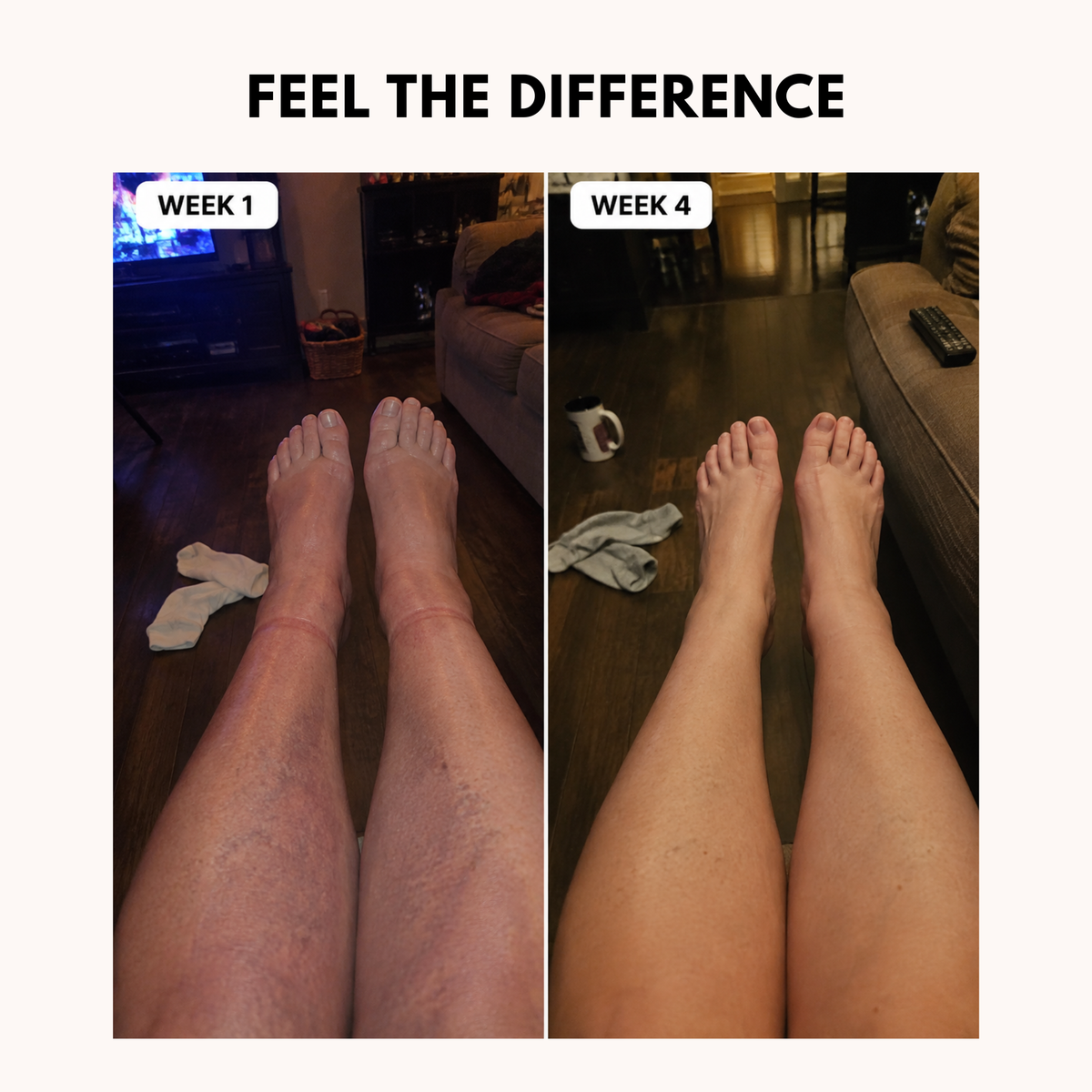 POWERCELLS™ | Light-Legs & Anti-Swelling Compression Leggings