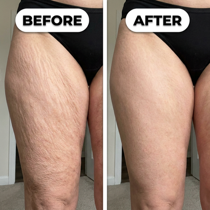 POWERCELLS™ | 3D Loose Skin Smoothing & Sculpting Leggings