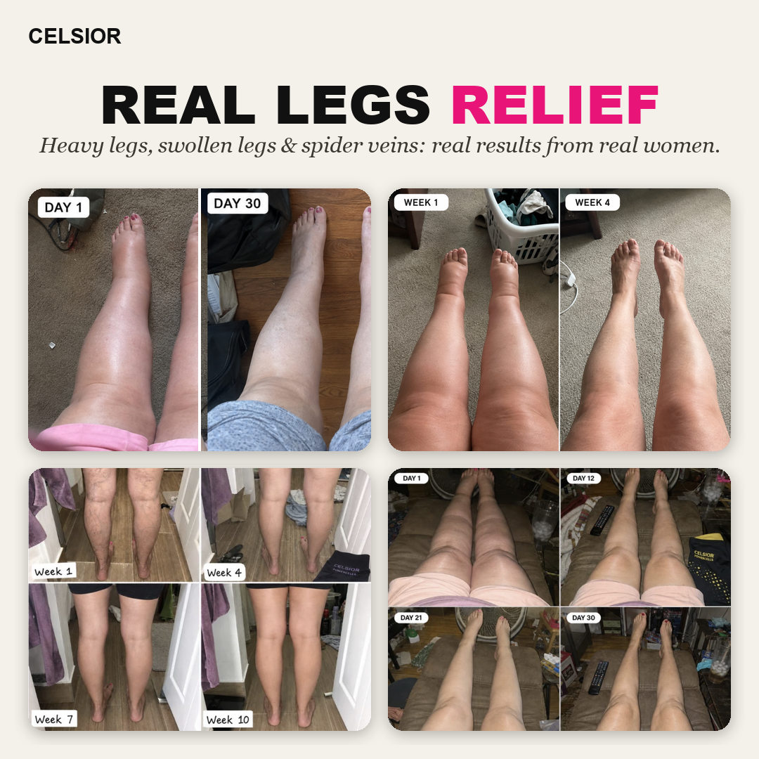 POWERCELLS™ | Anti-Cellulite, Smooth Skin & Light-Legs 3D Leggings