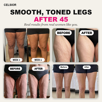 POWERCELLS™ | Anti-Cellulite, Smooth Skin & Light-Legs 3D Leggings