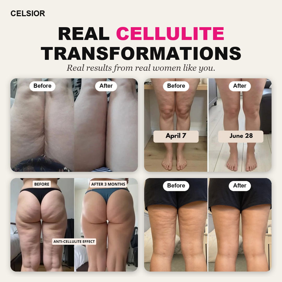 POWERCELLS™ | Anti-Cellulite, Smooth Skin & Light-Legs 3D Leggings